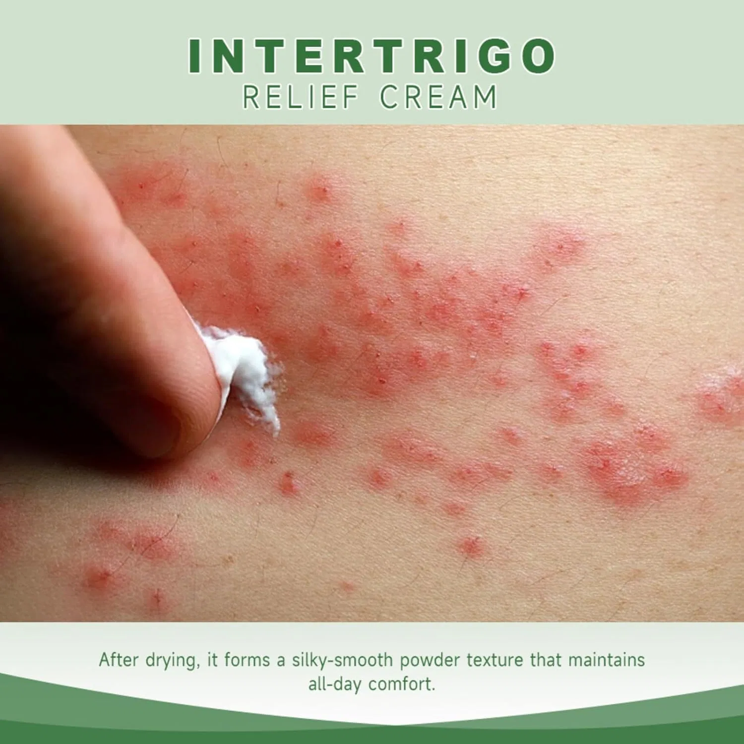 Крем для кожи Intertrigo Relief Cream, 60 г, 1PCS Generisch — фото 3