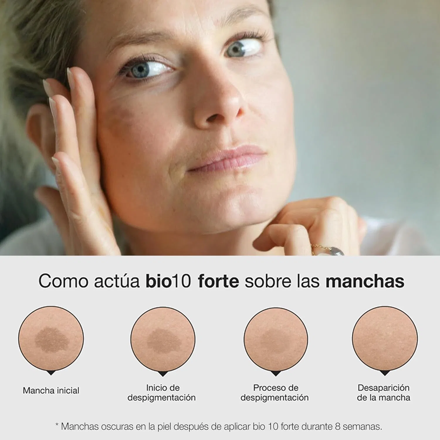 Крем для лица Bio10 Forte 30 мл, BELLA AURORA, Normal — фото 4