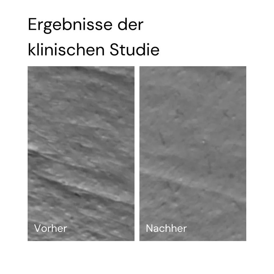 Сыворотка MERME Berlin — Увлажняющая , молочные капли, увлажняющий, 50 мл — фото 4