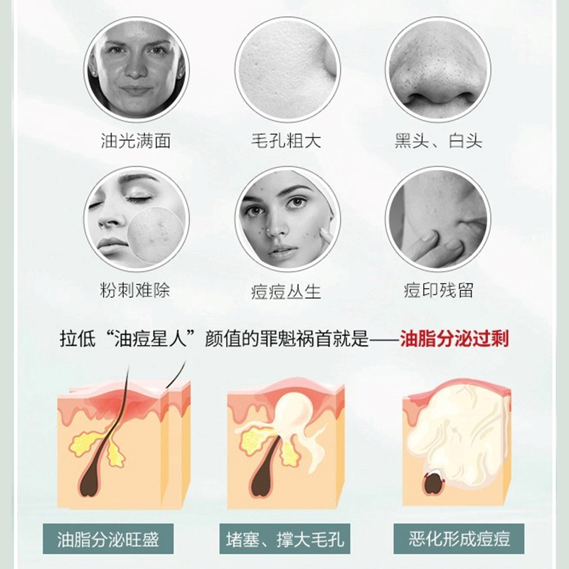Набор для ухода за кожей против акне и для сияния Winona, [4 Pcs Set]Acne-Fighting Serum & Clothing Set — фото 4