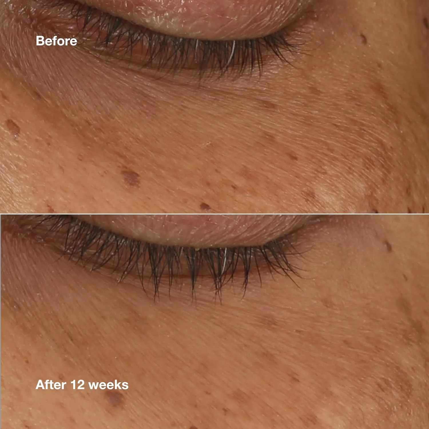 Осветляющая сыворотка-концентрат Clinique All About Eyes с витамином С, гиалуроновой кислотой и ретинолом | Увлажняющая и уменьшающая темные круги под глазами, 0,34 жидких унции — фото 4