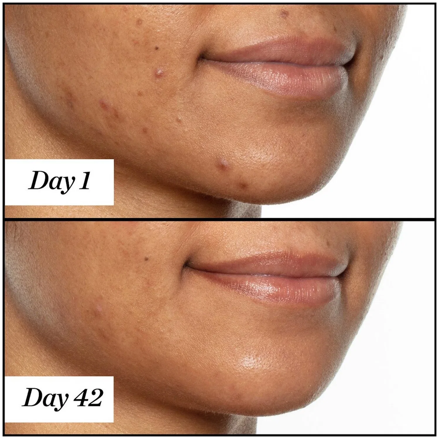Масло для лица очищающее с салициловой кислотой U.F.O. Ultra-Clarifying Face Oil Sunday Riley, 15 мл — фото 3