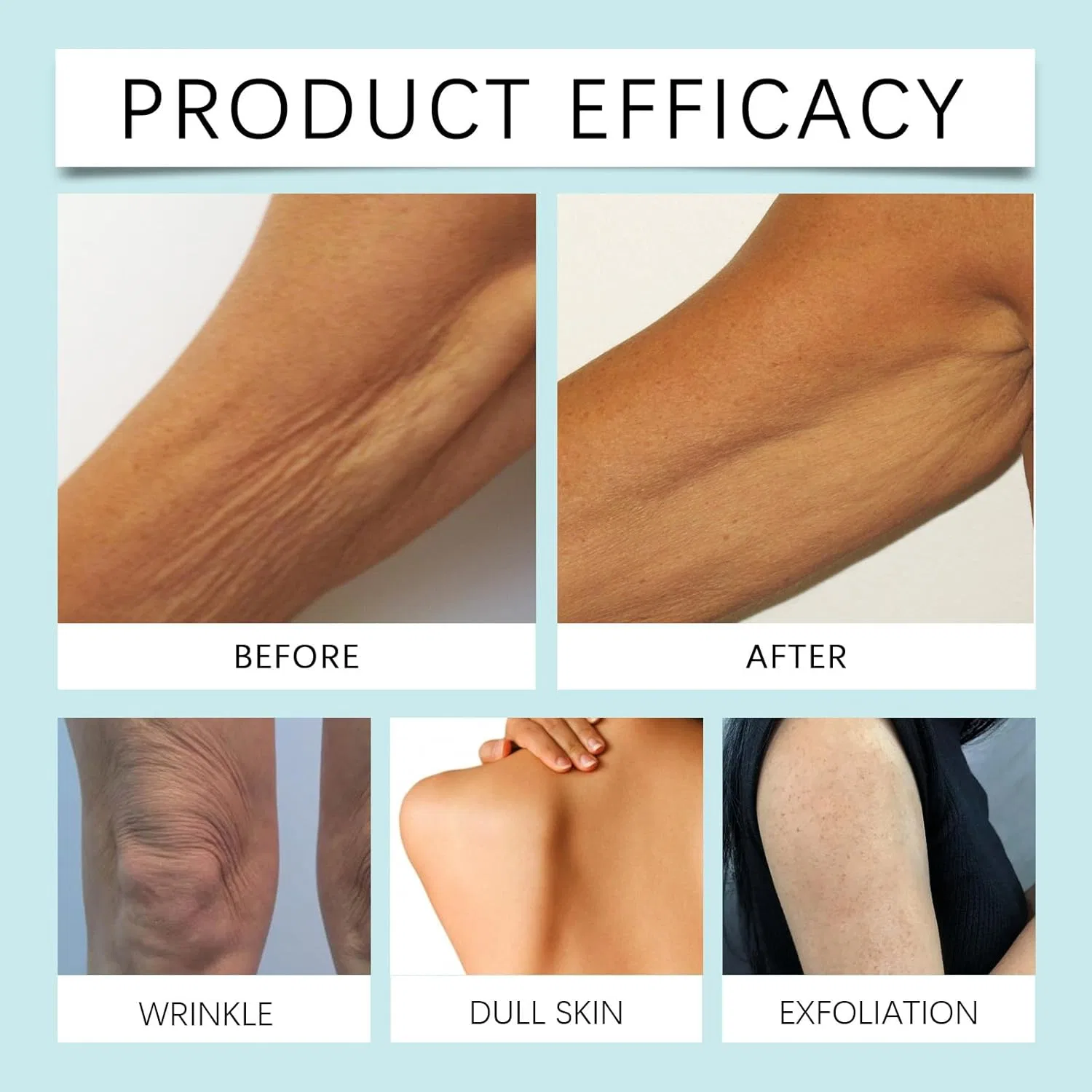 Крем для тела Cellu Crepey Skin Repair Treatment, YUNFAX, 50 г, 2 pieces — фото 3