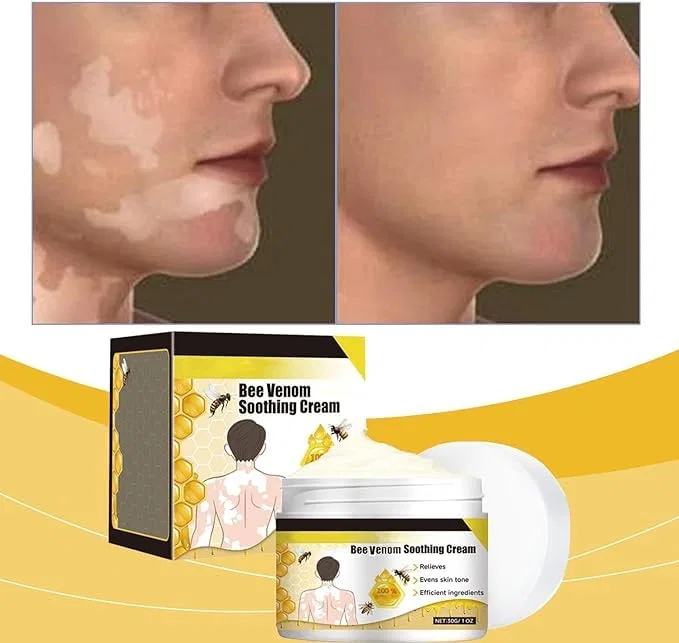 Крем для тела VitiClear Pro Bee Venom, 30 г, 3 шт Eunmsi — фото 4