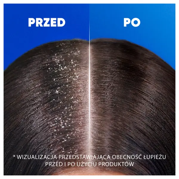 Шампунь против перхоти с кондиционером 2в1 для волос, 330 мл Head&Shoulders Menthol fresh — фото 2
