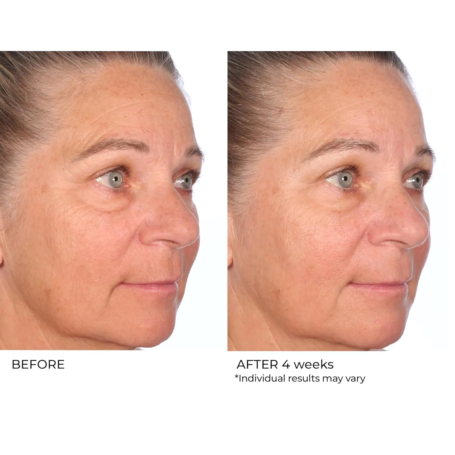 Масло для лица Nassifmd — Restore & Firm Face Oil с CoQ10 - клинически протестированное масло для восстановления — фото 2