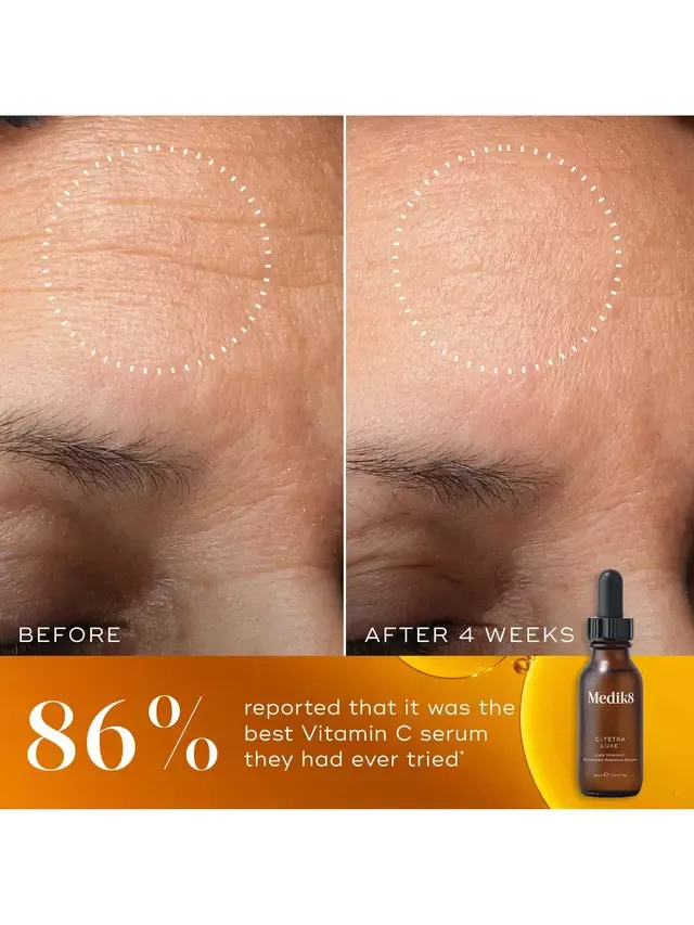 Сыворотка Medik8 — Для придания сияния кожи C-Tetra Luxe Lipid Vitamin C, 30 мл — фото 3