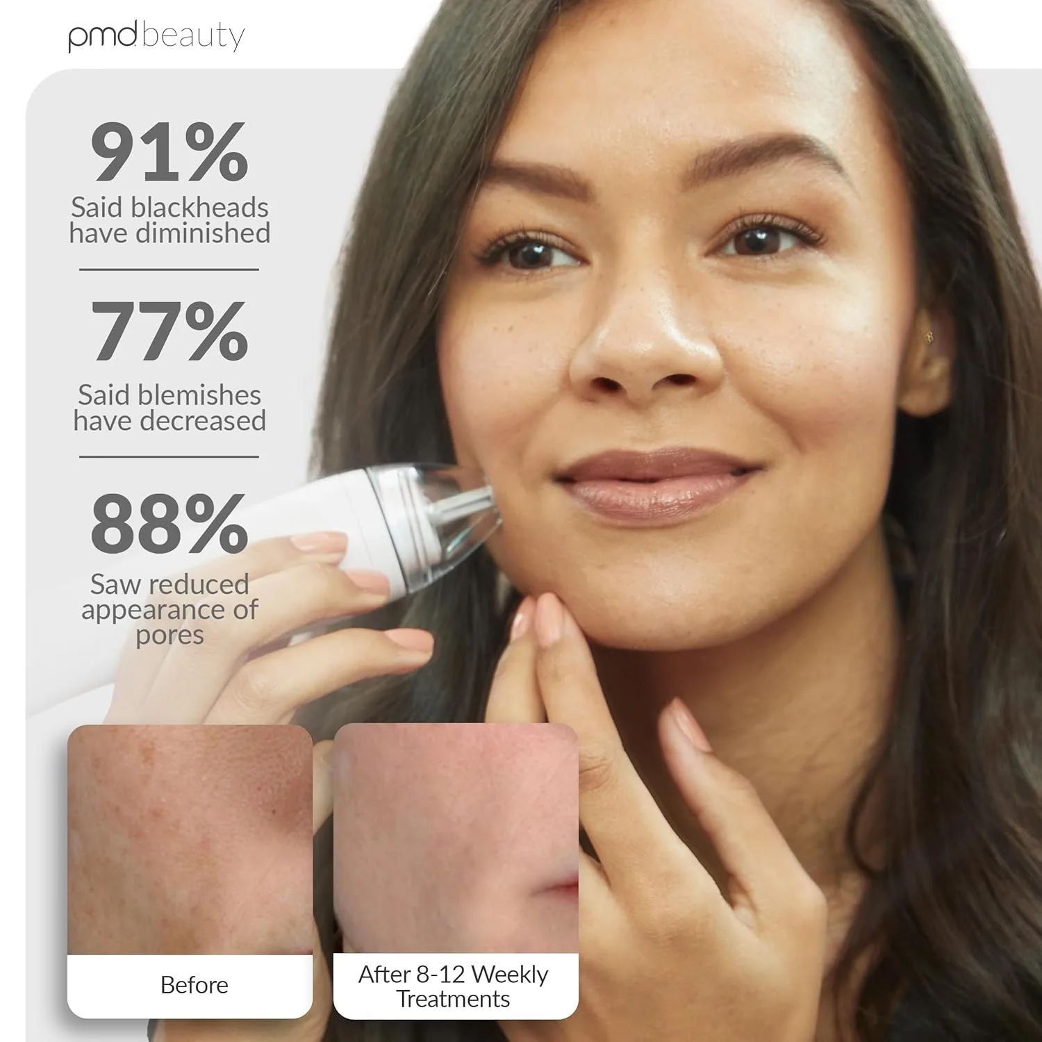 PMD Beauty Personal Microderm Pro - Инструмент для микродермабразии для домашнего использования, отшелушивающий скраб для лица и тела., White — фото 4