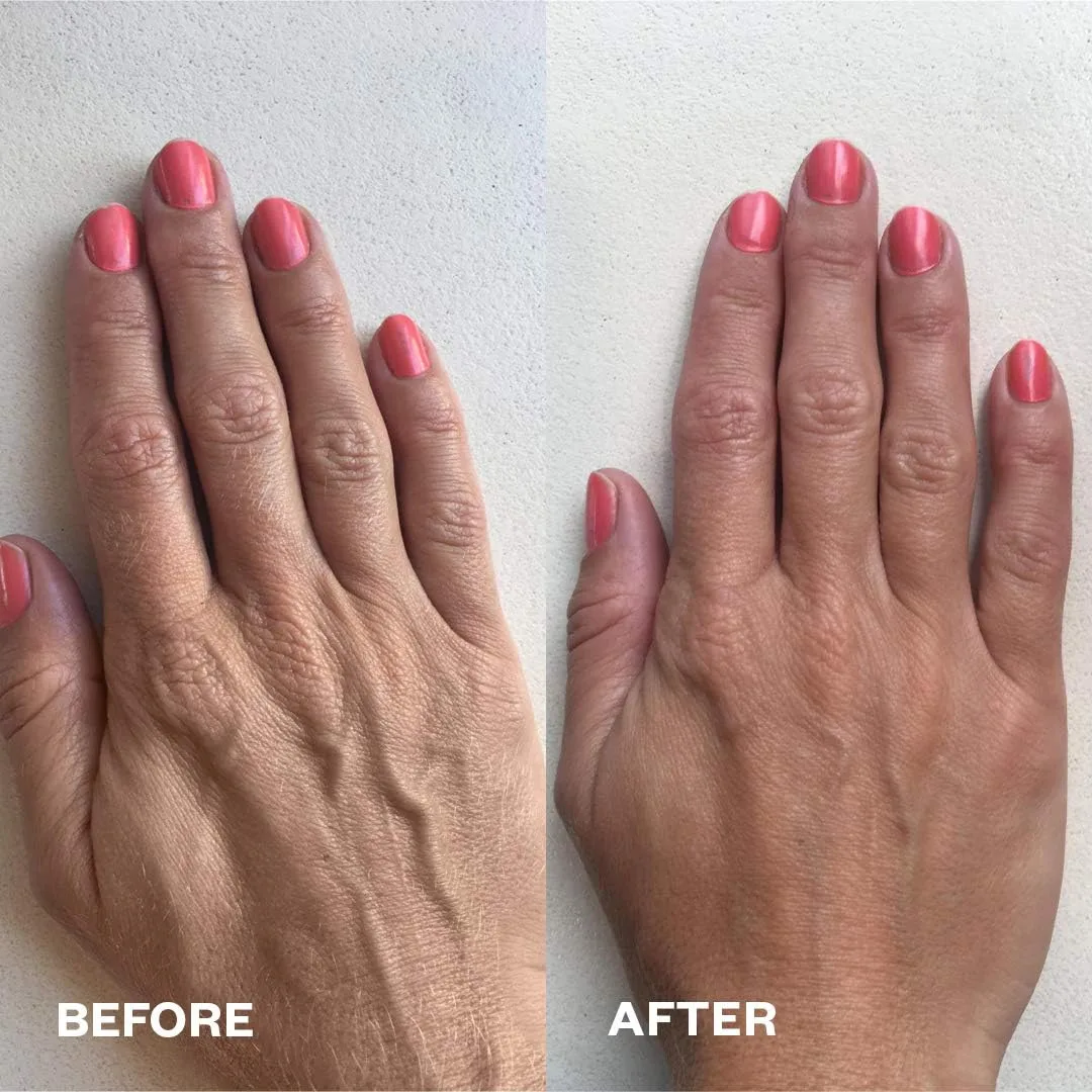 Патчи для рук Wrinkles Schminkles - многоразовые силиконовые накладки от морщин для обезвоженной, поврежденной и подверженной воздействию солнца кожи, 2 шт 1 шт. (2 шт.) — фото 3