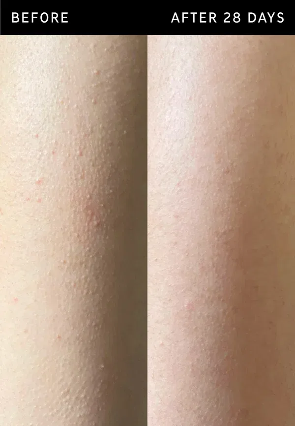 Пилинг-стик с гликолевой кислотой, для сухой кожи, Glycolic acid exfoliating body stick, The Inkey List, 45 г — фото 4