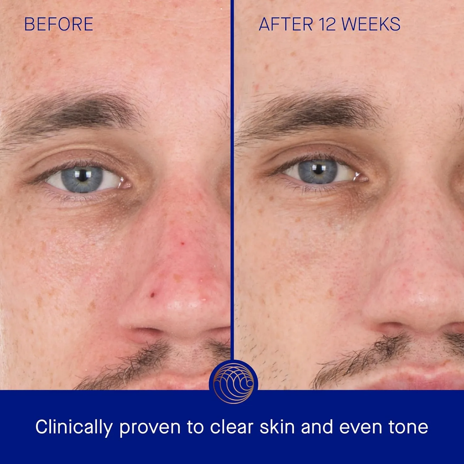 Augustinus Bader The Retinol Serum - антивозрастная сыворотка для лица, разглаживает морщины, повышает упругость и сияние 29,6 мл (1 шт.) — фото 3