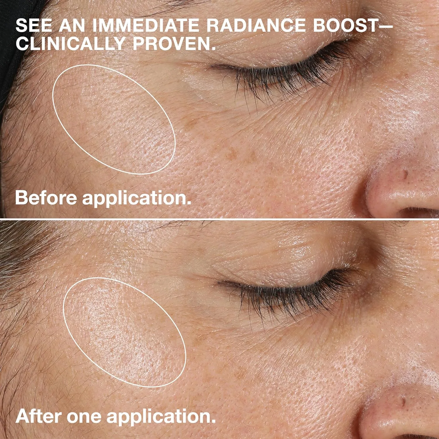 Тоник Clinique — Step Clarifying Lotion Face Exfoliator | с гамамелисом | Для сухой и комбинированной кожи, 198 мл — фото 3