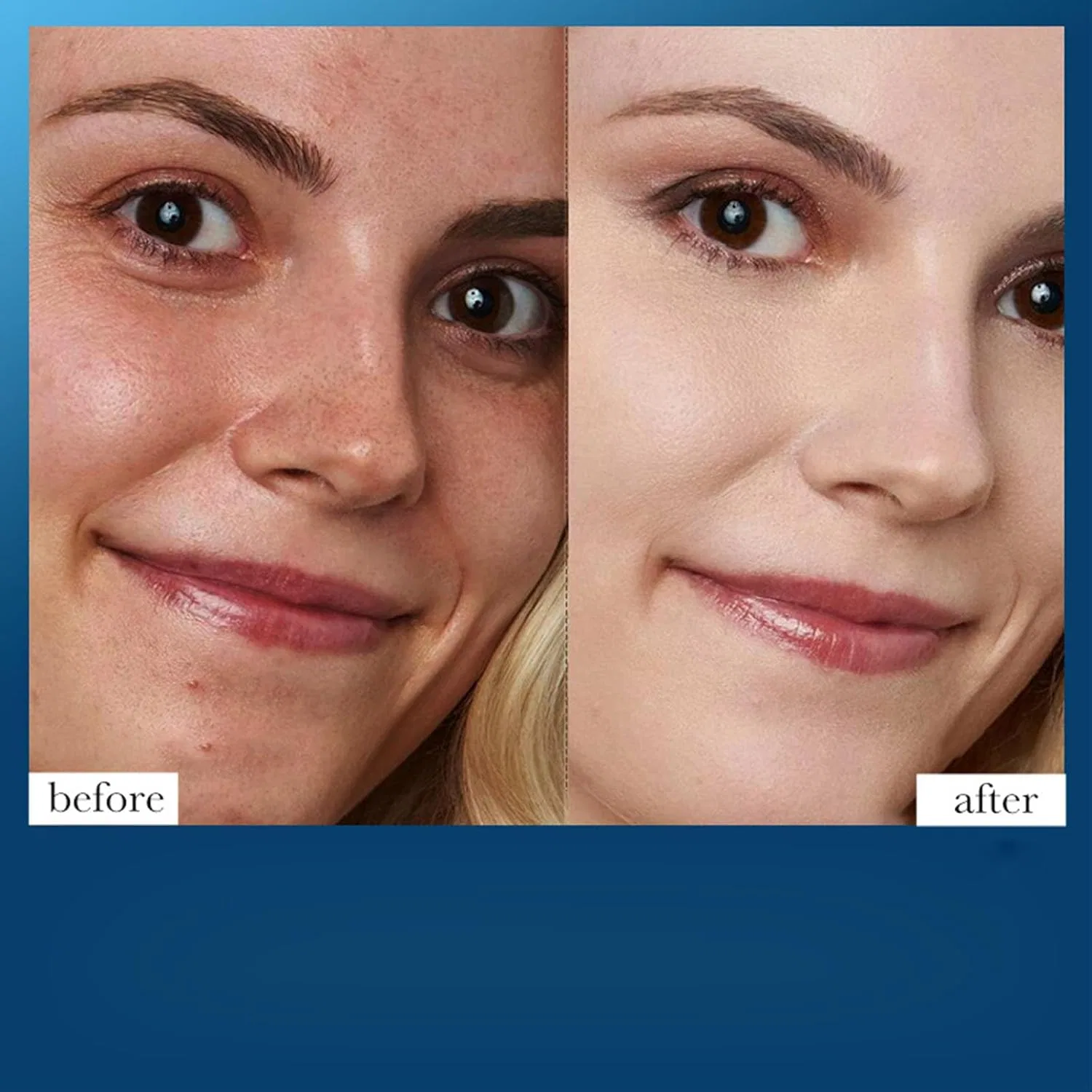Маска для лица — Пленка очищающая Dead Sea Mud Black Mask, 100 мл — фото 4
