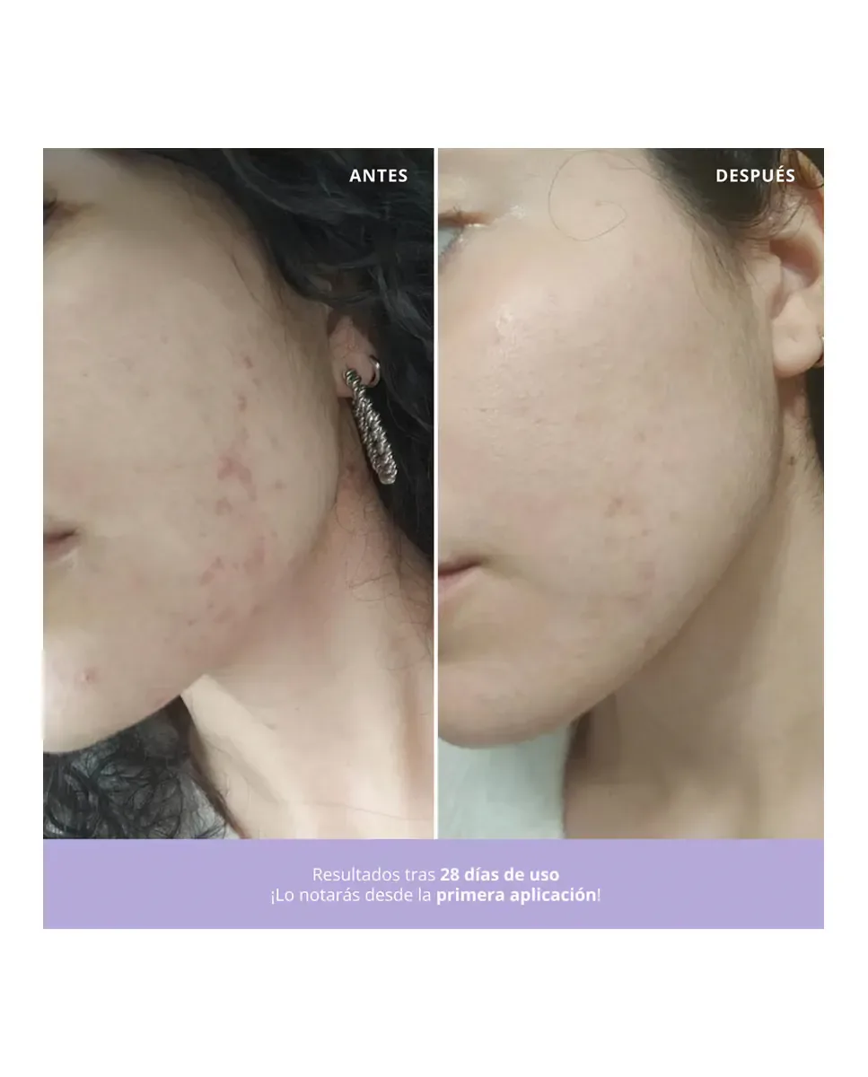 Крем для лица Freshly Cosmetics — Гель с азелаиновой кислотой для сияния лица, 50 мл — фото 4
