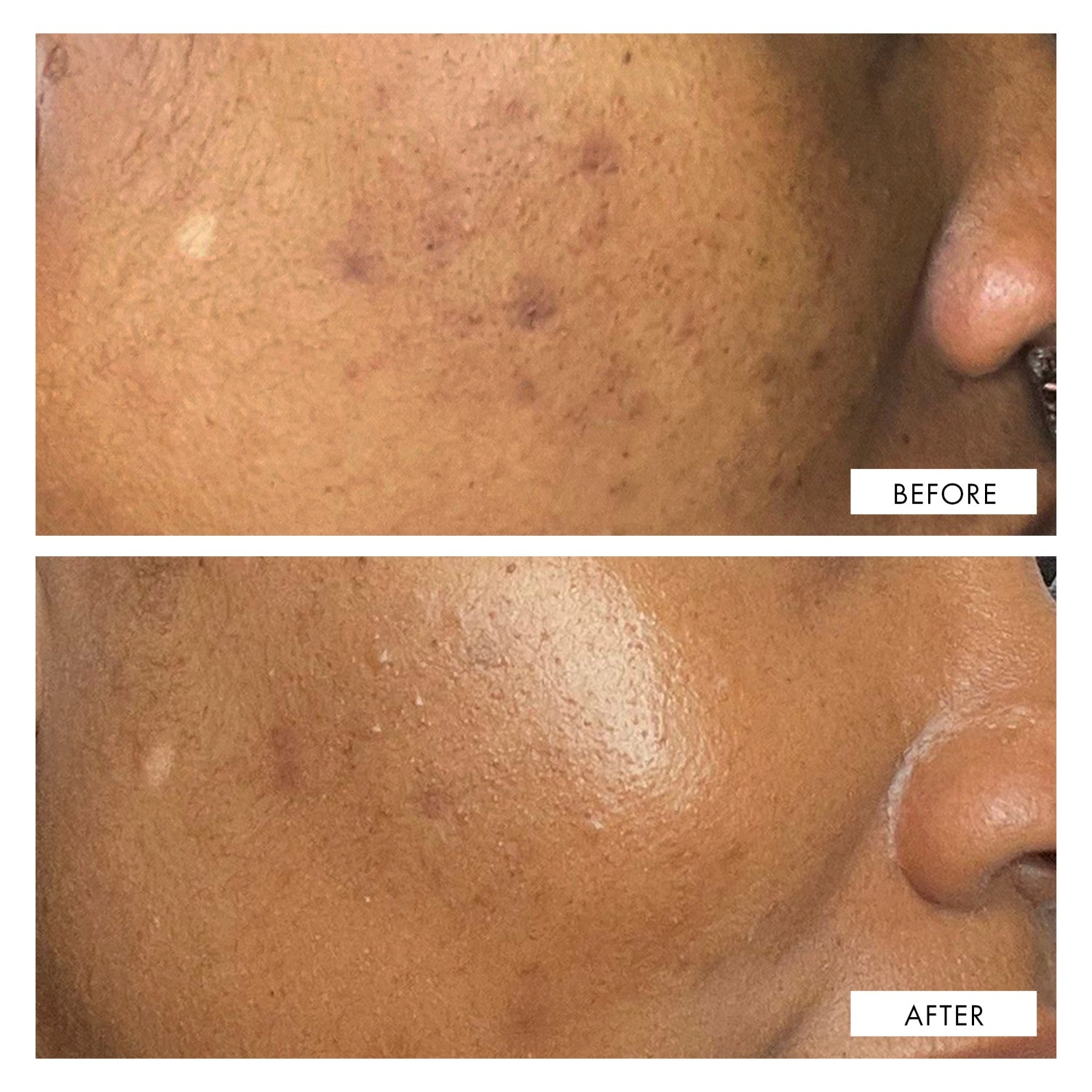 Сыворотка для лица treatment dark spot correcting serum 111Skin, объем 30 мл — фото 4