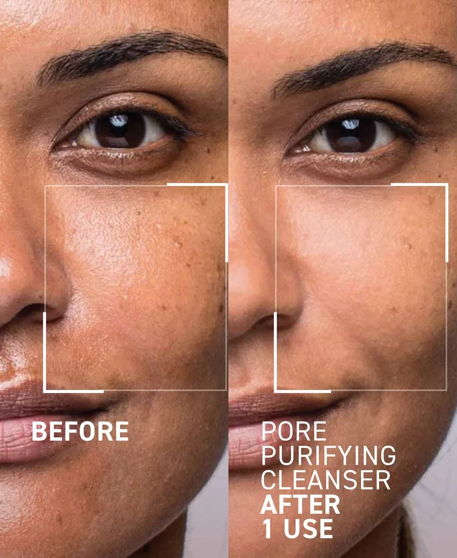 Очищающее средство для пор Pores No More, 120 мл Dr. Brandt, None — фото 2