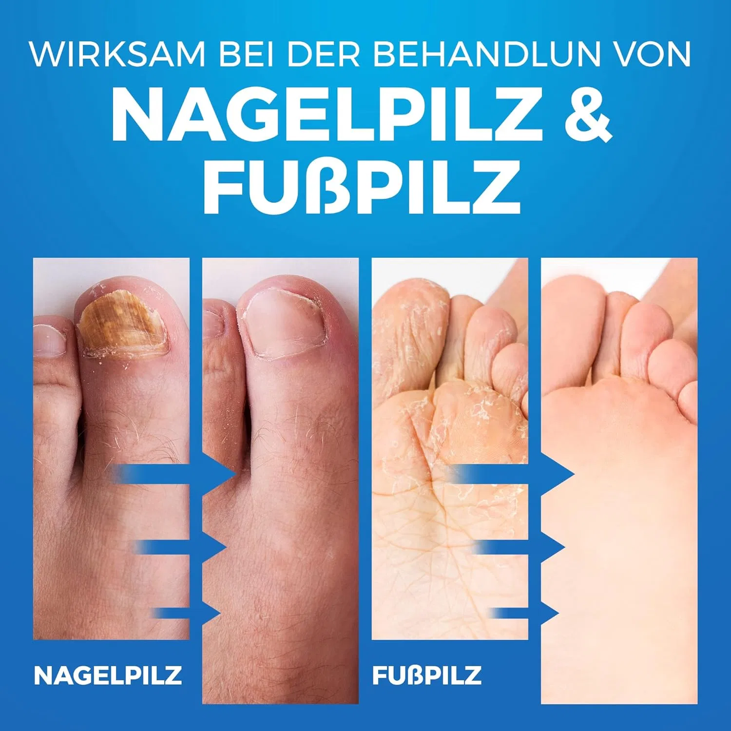 Спрей для ног против грибка и запаха, 150 мл Imperial Feet, Shoe & Sock Spray — фото 3