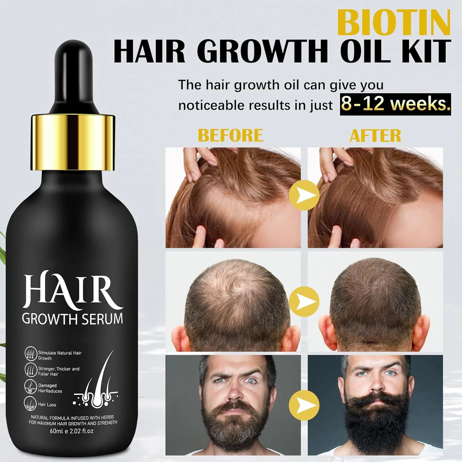 Набор для роста бороды Beard Roller с маслом и дермароллером Generisch — фото 3
