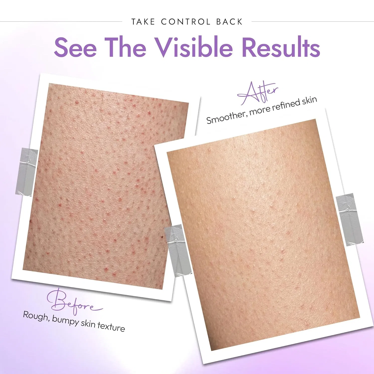 Скраб для тела DERMAdoctor KP Duty с 10% AHA + PHA Dermadoctor — фото 3