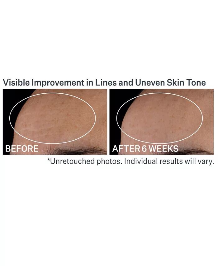 Advanced Retinol Ночная мультикорректирующая сыворотка Strivectin — фото 3
