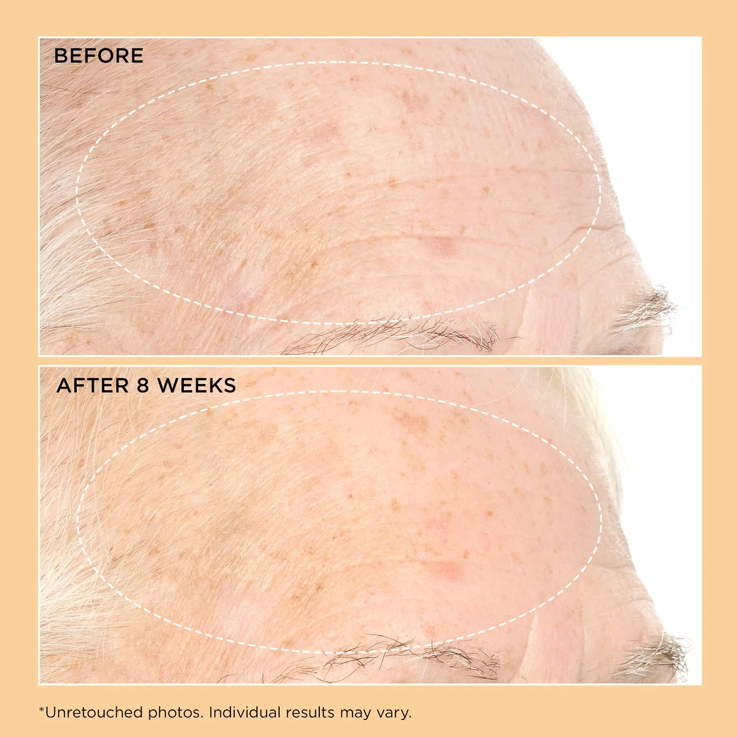 Увлажняющий крем Neuropeptide pro-strength для укрепления кожи Perricone Md — фото 3
