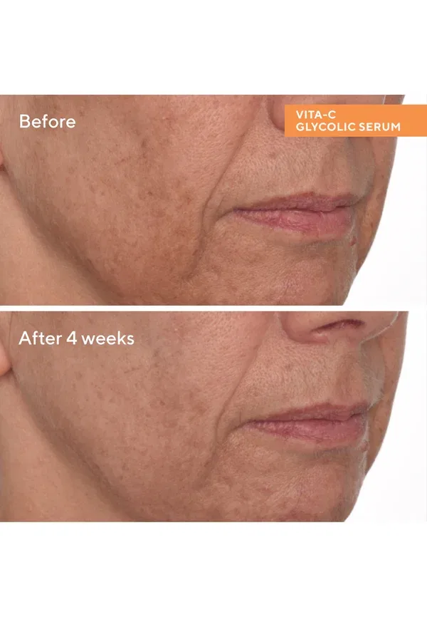 Сыворотка осветляющая Vita-c glycolic brightening serum Murad — фото 2