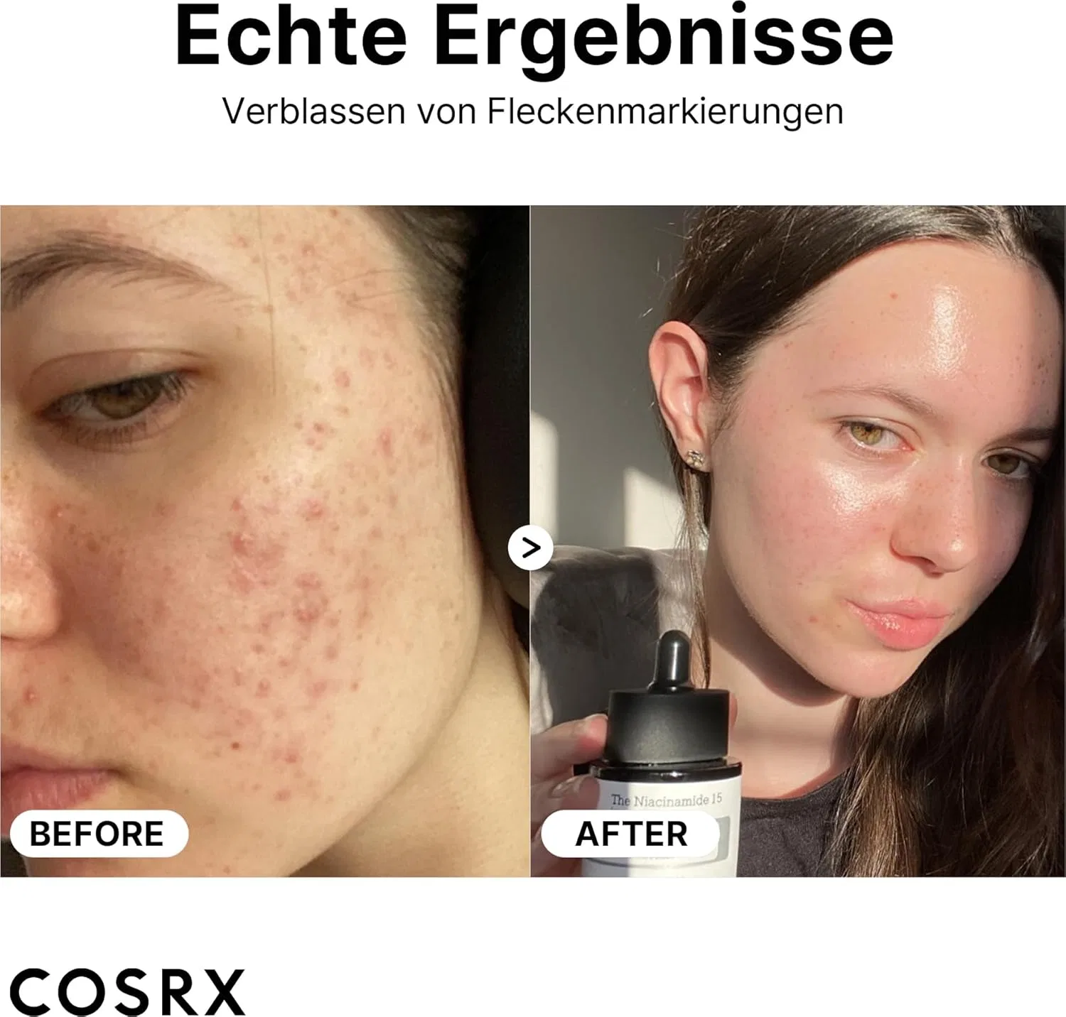 Сыворотка Cosrx — Для лица Niacinamide % с ниацинамидом — фото 2