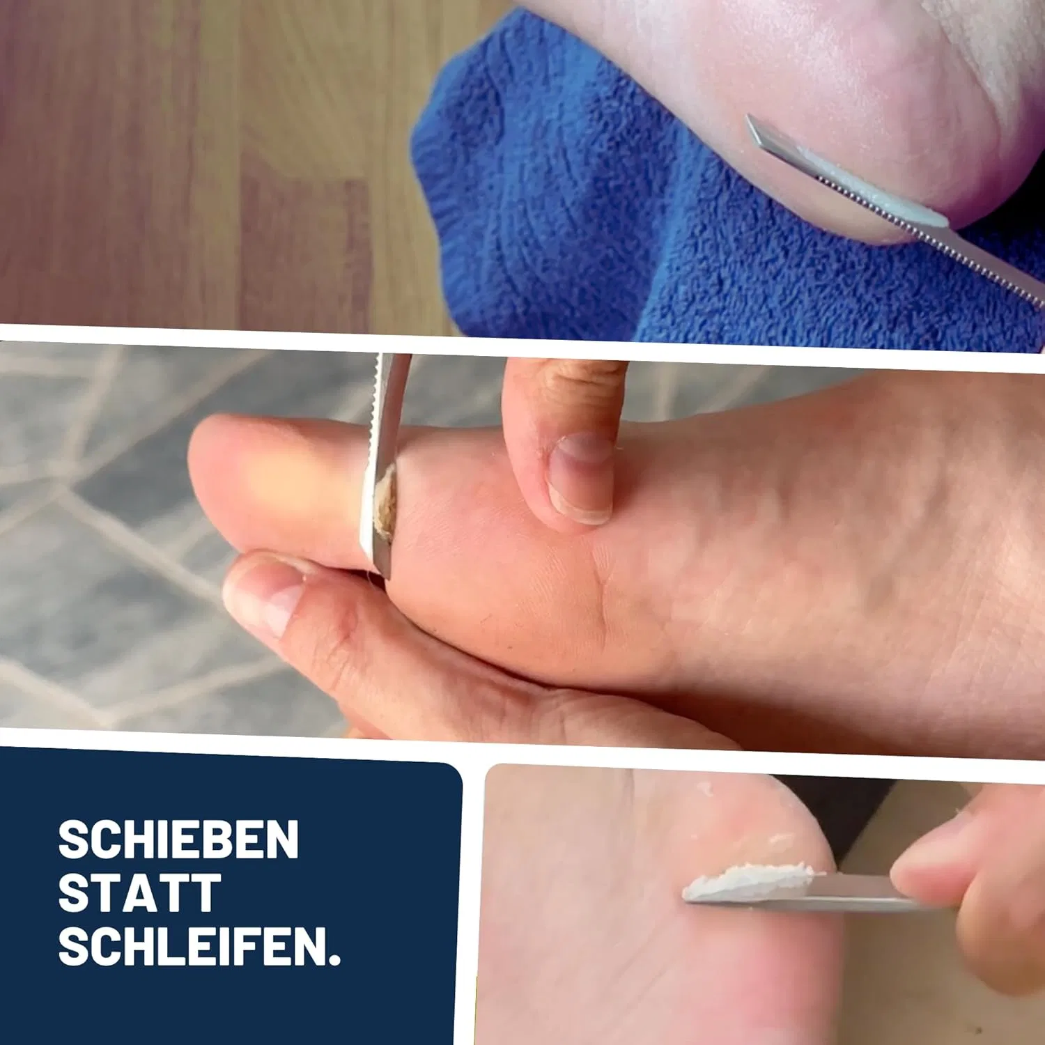 Набор для удаления мозолей «Callus Remover Active Solution No. 4 Plus Pack Steel Classic» от Mr. Fuss ‎Mr. Fuss — фото 4