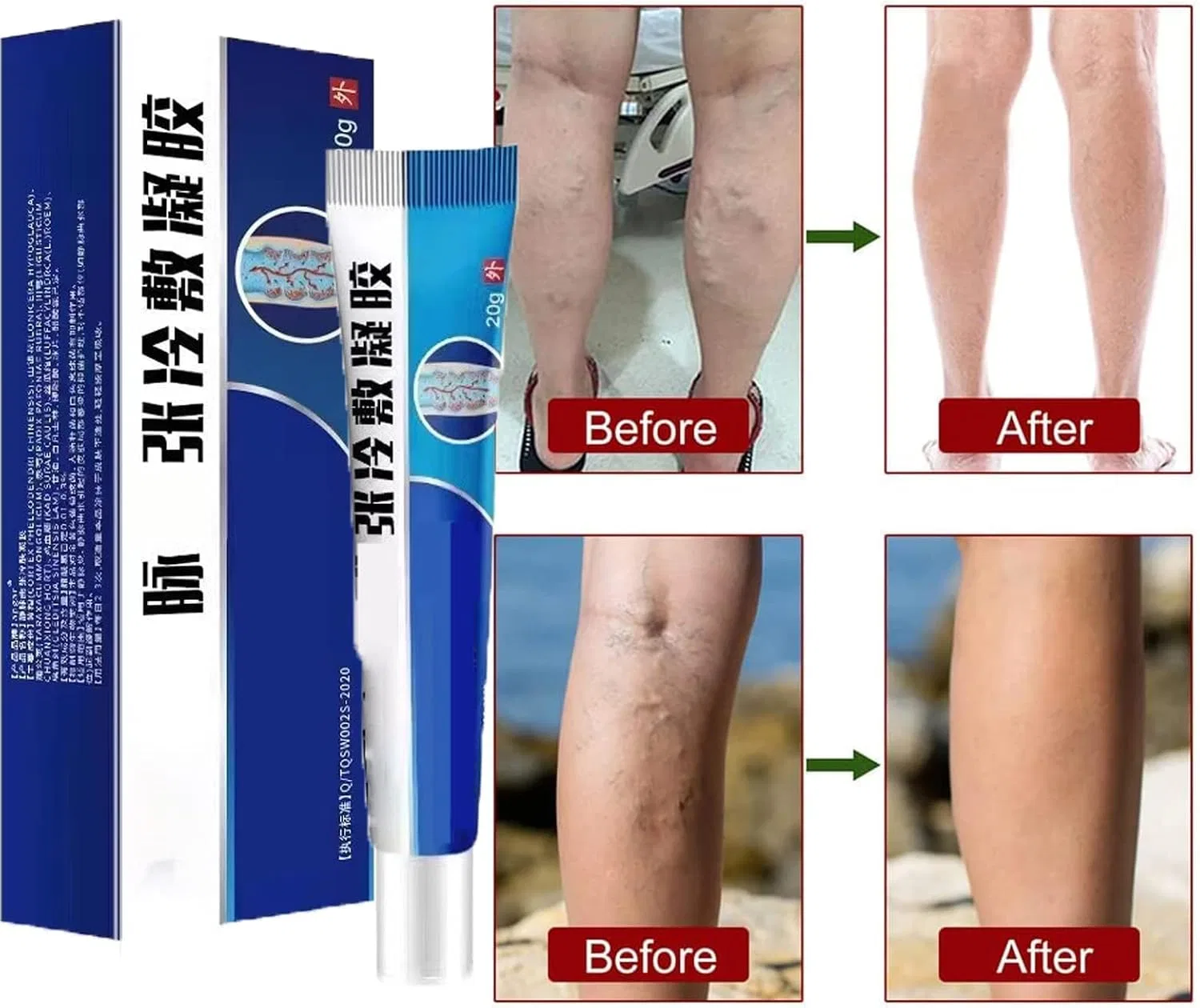 Крем для ног от варикоза Cold Compress Gel DUBUSH, 20 г — фото 2