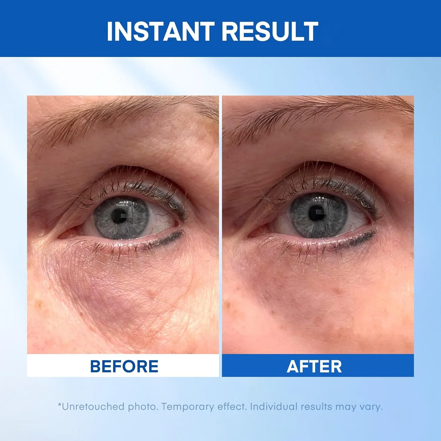 Сыворотка для век лифтинг-мгновенная HealthyDerm 20 мл — фото 3