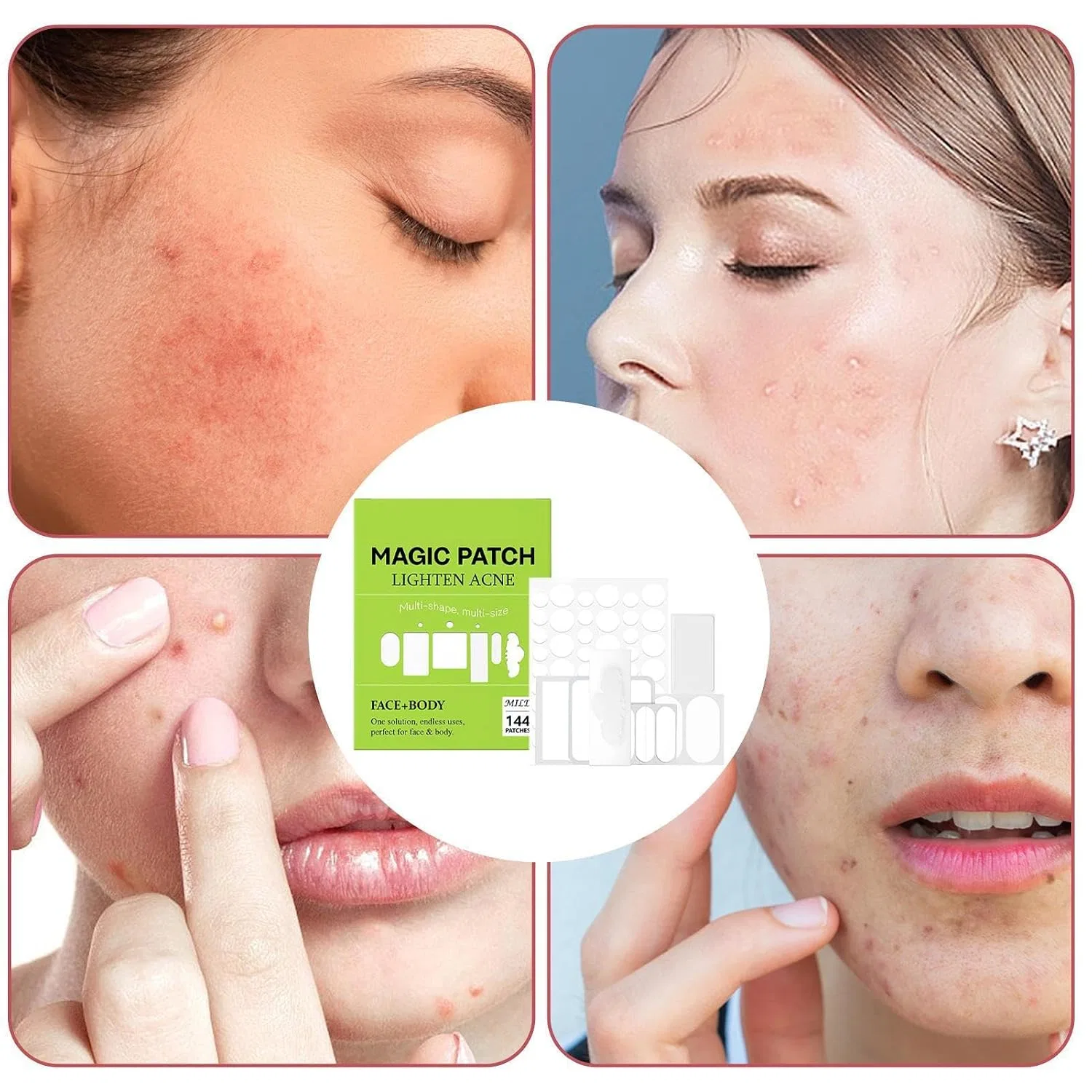 Патчи для лица от прыщей, дышащие, 144 шт Genérico — фото 4