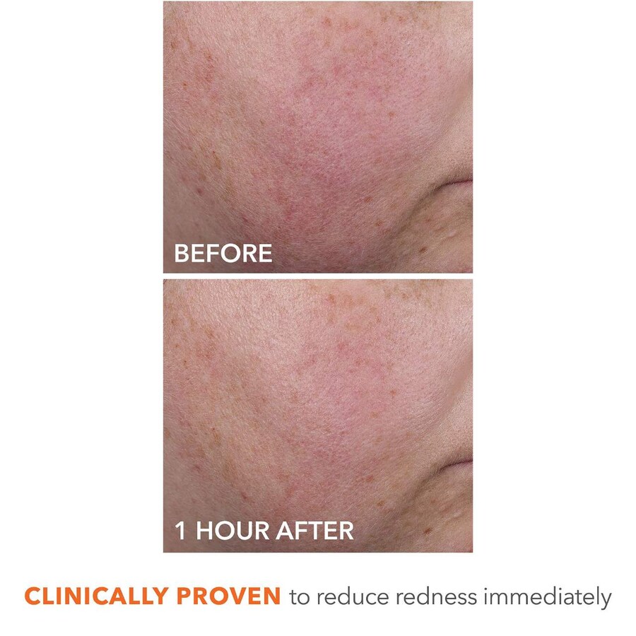 Сыворотка Dr. Dennis Gross Skincare — DermInfusions Blur + Repair с гиалуроновой кислотой и пептидами, 50 мл — фото 4