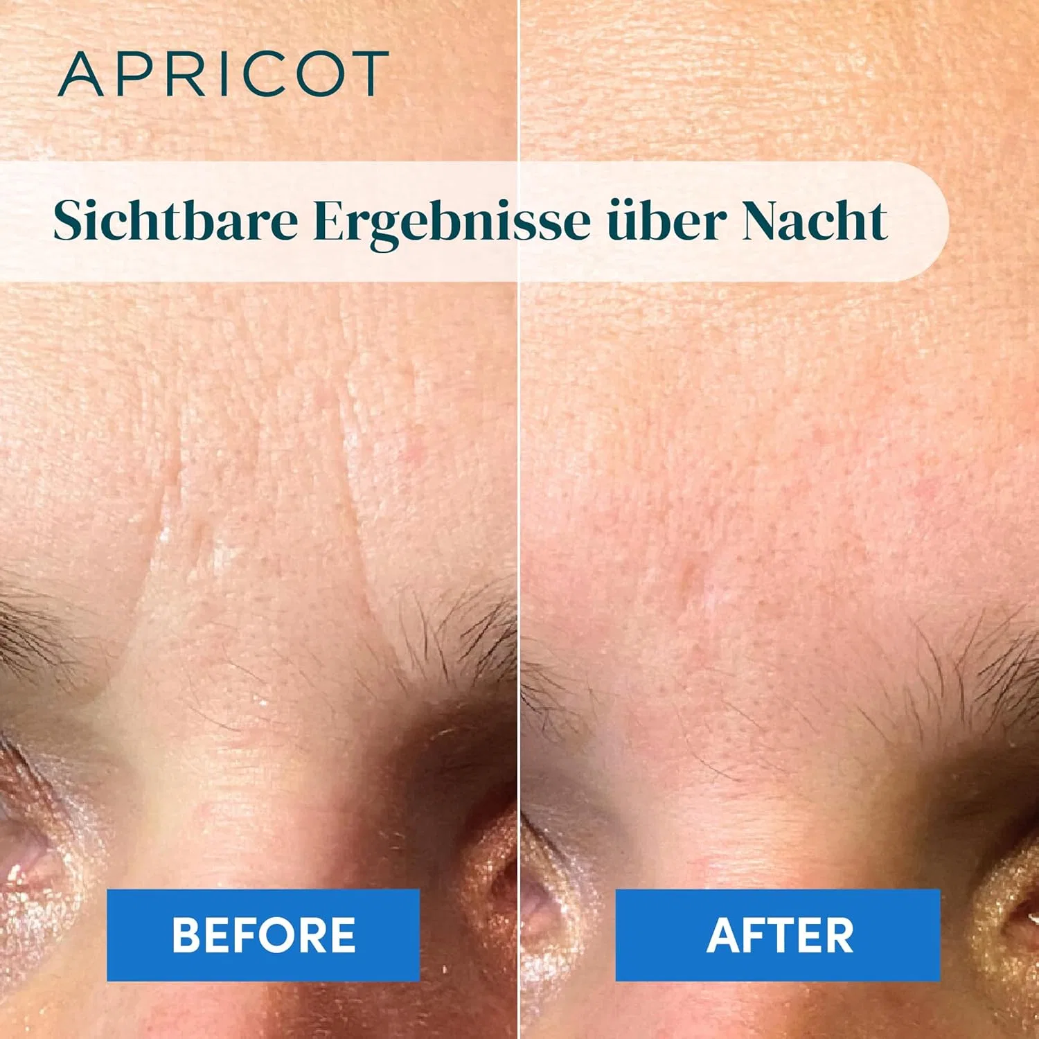 Патчи от морщин с гиалуроновой кислотой «Down the Frown» от Apricot, 120 шт. Apricot Beauty & Healthcare, Hyaluronic (Blue) For Normal To Dry Skin — фото 4