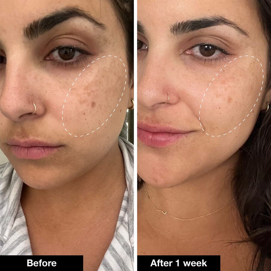 Сыворотка Innbeauty Project — Retinol Remix %: с ретинолом, пептидами и транексамовой кислотой — фото 2