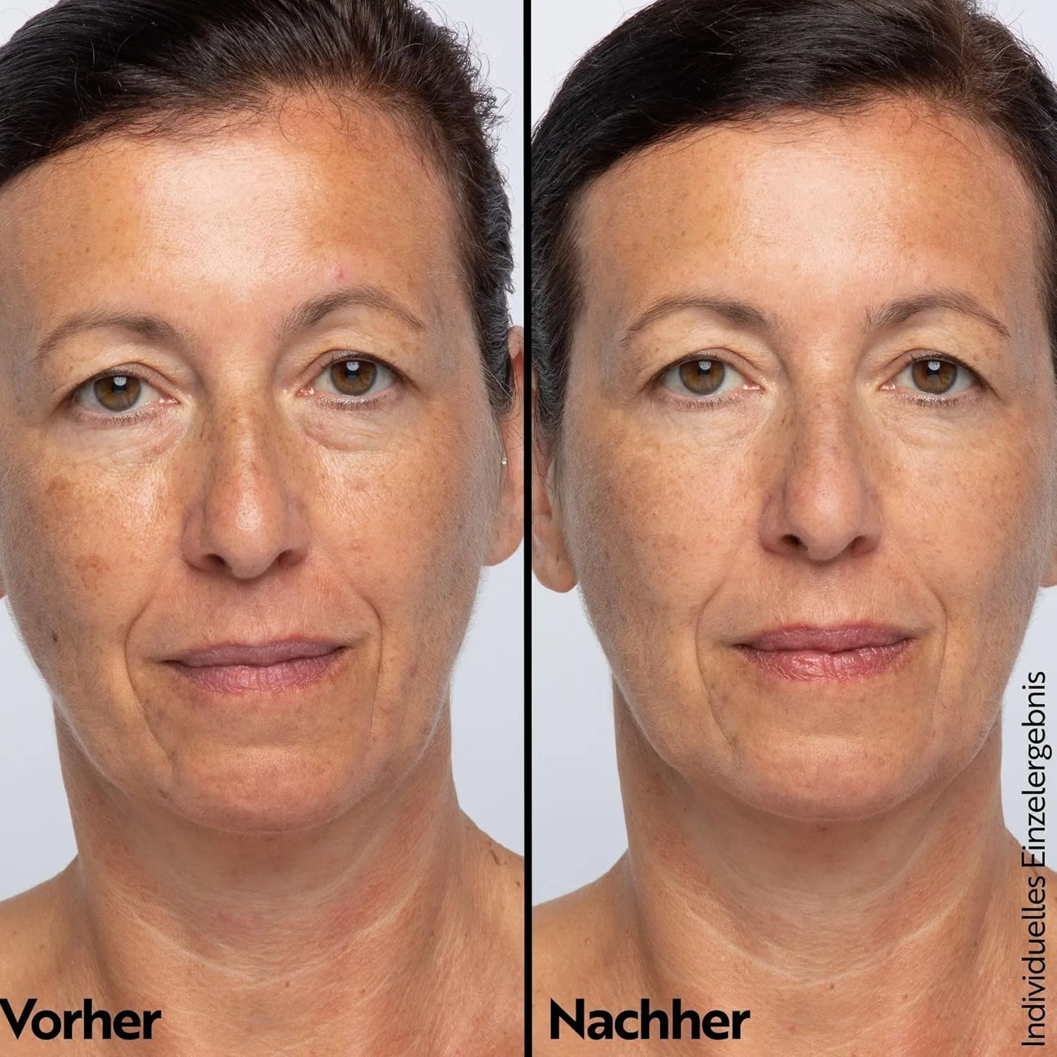 Насыщенный бальзам для глаз «Retinol Intense Eye Balm» от M. Asam M. Asam — фото 3