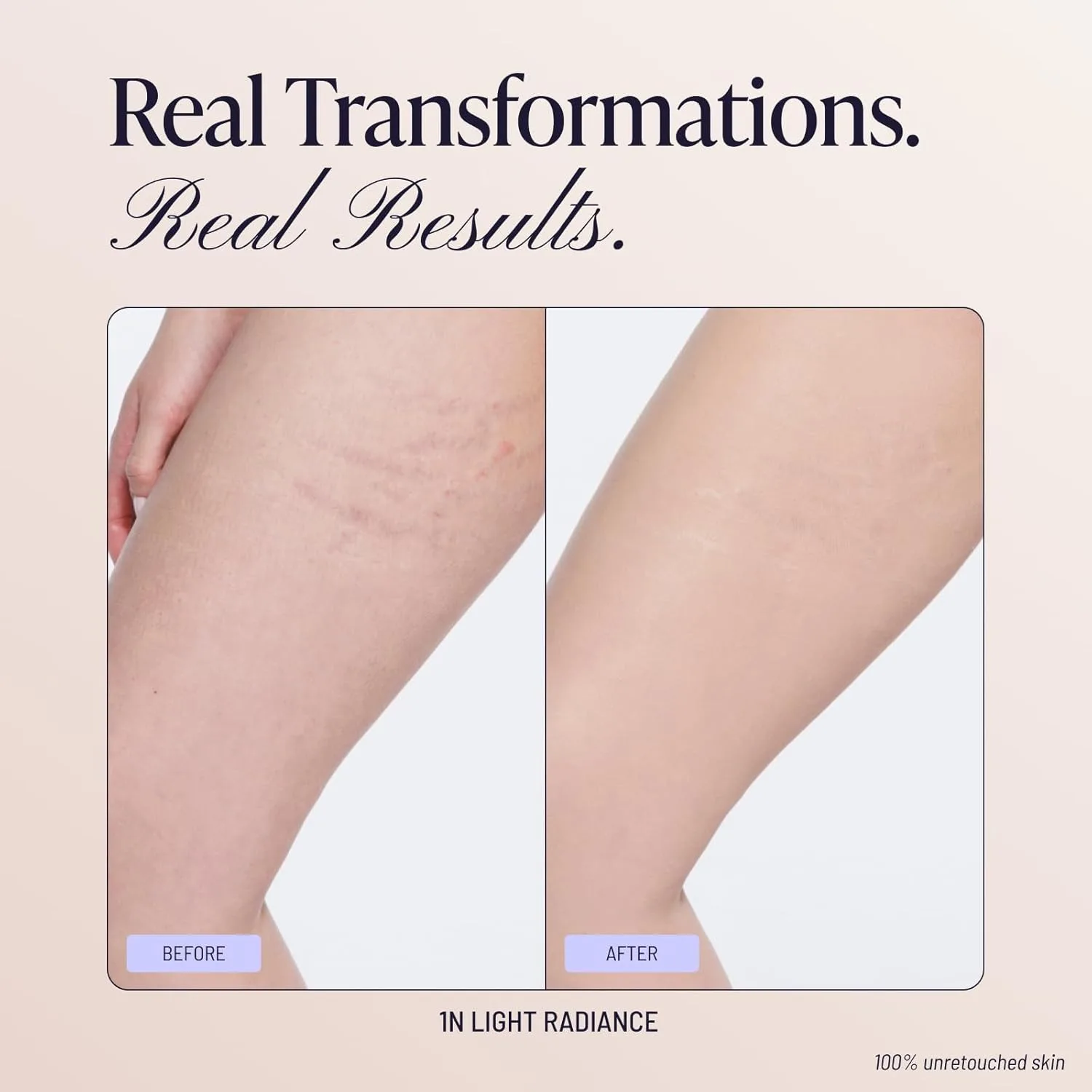 Westmore Beauty Body Coverage Perfector - Водостойкий макияж для ног и тела/бронзер для женщин - Лучший консилер для маскировки татуировок - 7 унций, легкий оттенок, 7 Oz Light Radiance — фото 4