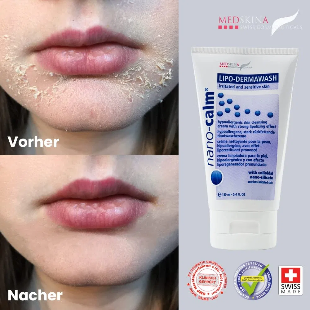 Лосьон Medskina Swiss Cosmeceuticals — Для умывания без отдушек pH . , , Cleansing Gel, 200 мл — фото 2