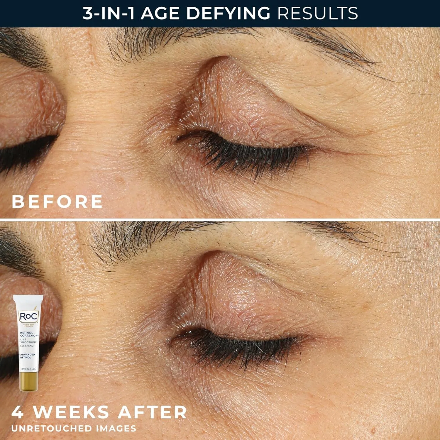Набор RoC — Дневной Retinol Correxion Deep Wrinkle Repair от , набор 30 мл + 15 мл — фото 4