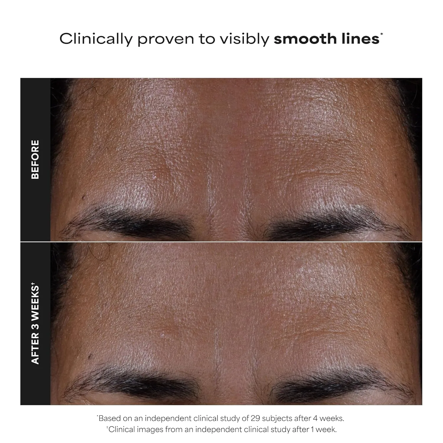 Paula's Choice SKIN PERFECTING 2% BHA жидкий эксфолиант с салициловой кислотой для пор, морщин и черных точек, без отдушки 29,6 мл — фото 3