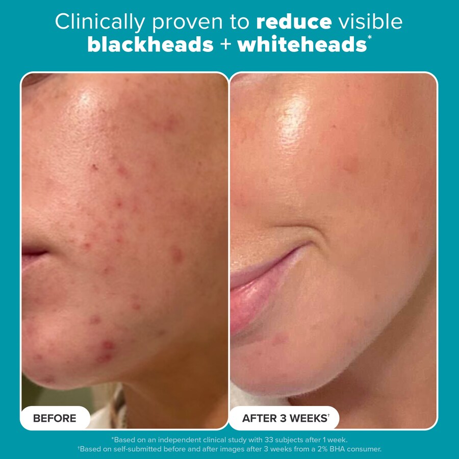 Тоник-пилинг Skin Perfecting с 2% BHA Paula's Choice — фото 2
