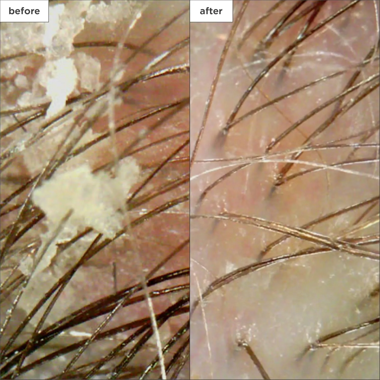 Briogeo Scalp Revival шампунь с древесным углем и кокосовым маслом для микроотшелушивания, без сульфатов, для сухой, зудящей или жирной кожи головы, детокс и увлажнение, веганский, cruelty free 237 мл (.) — фото 4
