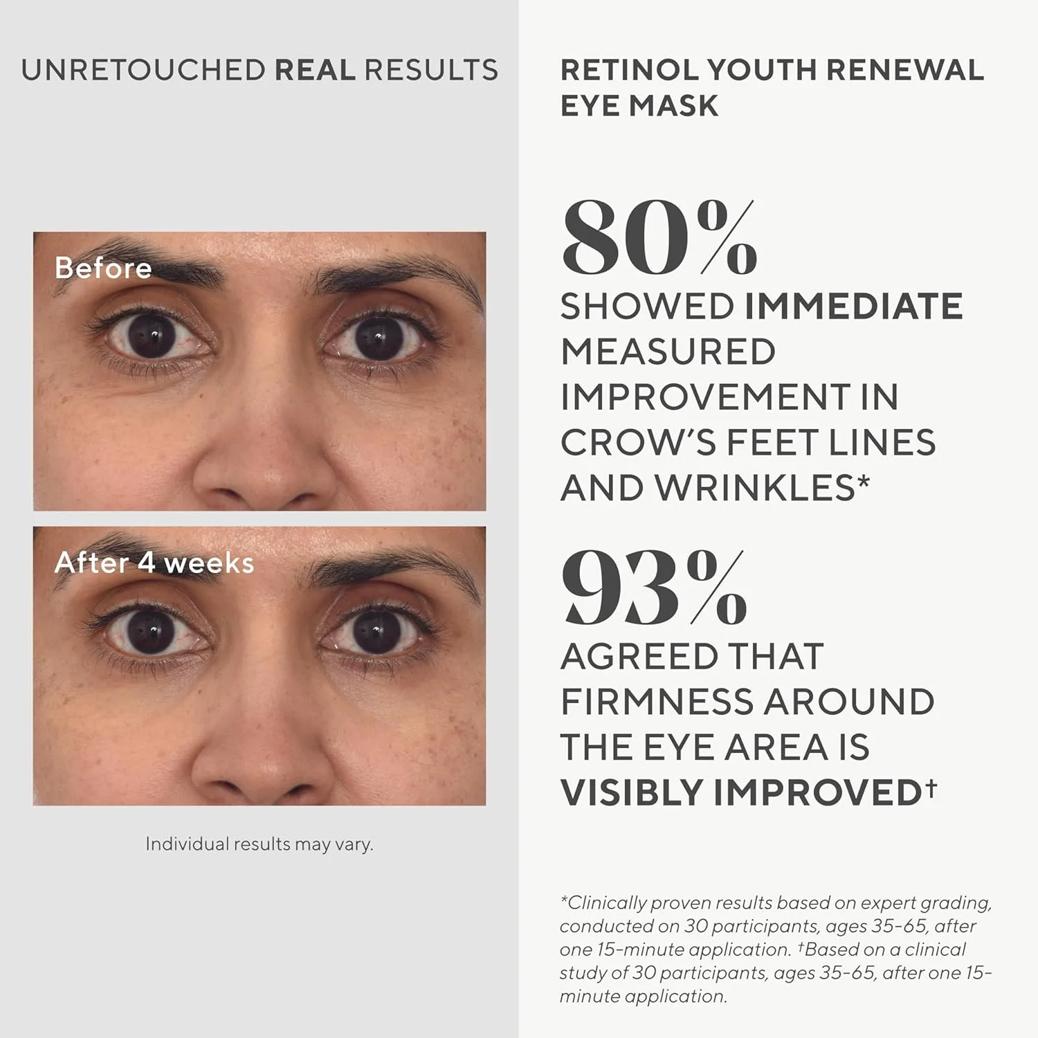 Патчи для кожи вокруг глаз Murad Retinol Youth Renewal с ретинолом, голубым агавой и маракуйей - нескользящие, с полным впитыванием, для борьбы с морщинами и отечностью. 5 пар (1 шт.), Blue — фото 2
