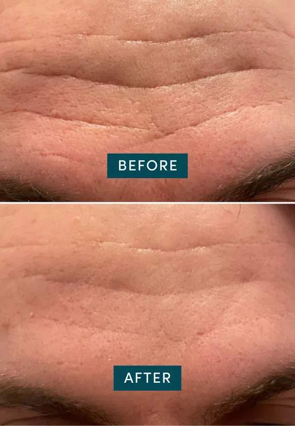 Патчи для лица с ниацинамидом - тканевая маска 30 г Apricot Beauty — фото 3