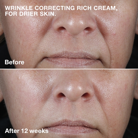 Питательный крем против морщин Clinique Smart Clinical Repair Wrinkle Correcting Cream, 75 ml — фото 3