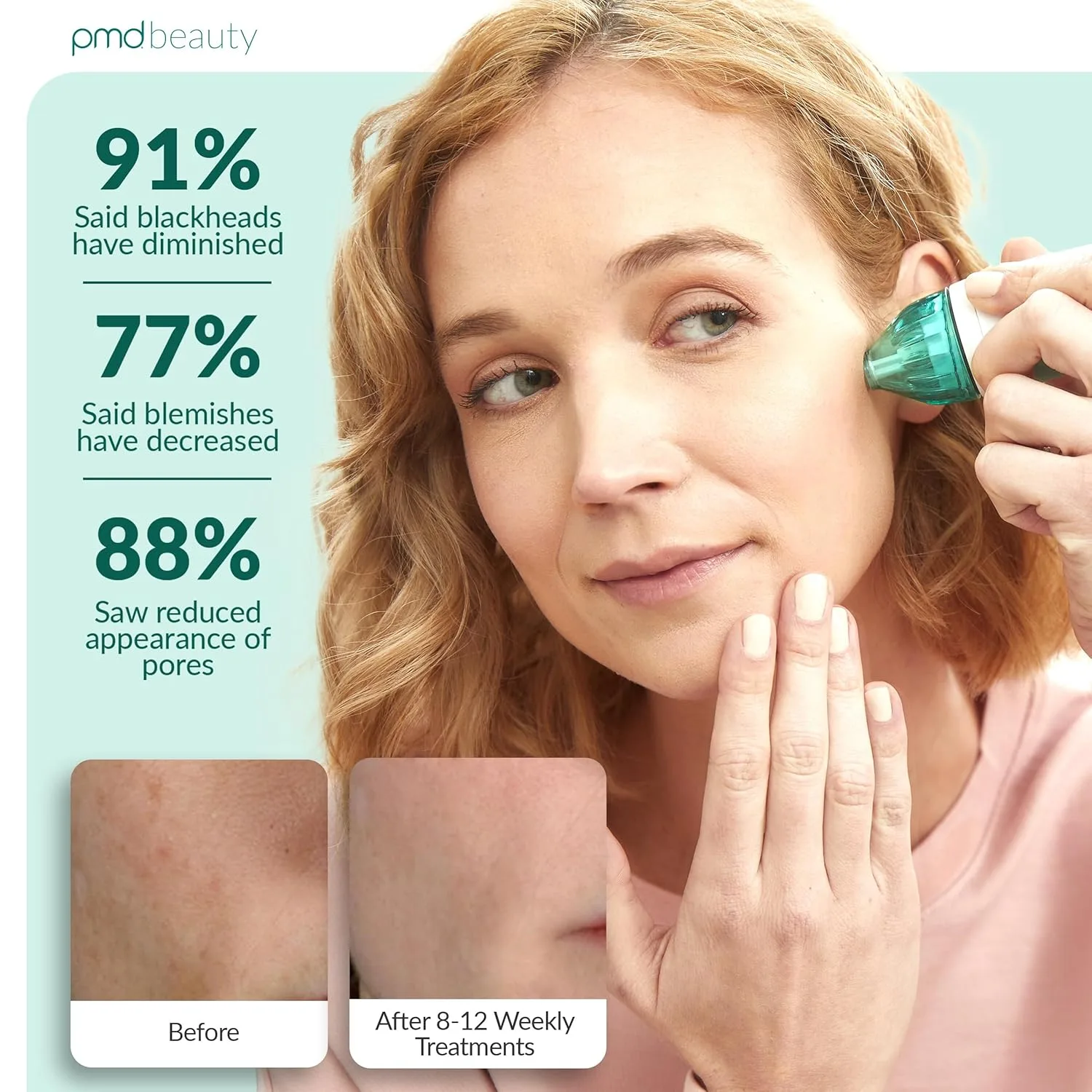 PMD Beauty Personal Microderm Classic - Набор для домашнего использования, инструмент для отшелушивания кожи лица, микродермабразия для ухода за кожей лица и тела. Pmd Personal Microderm, Teal — фото 3