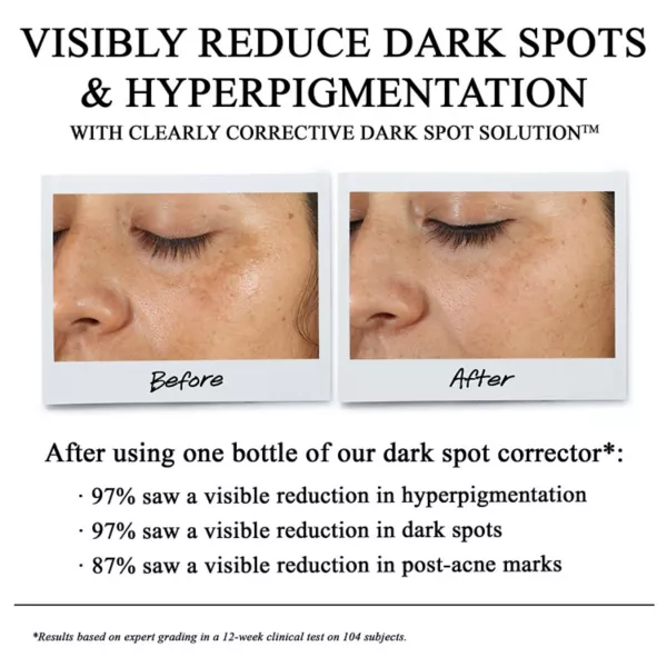 Сыворотка Kiehl's — Корректирующая для устранения темных пятен Clearly Correcting Since, 29 г — фото 2
