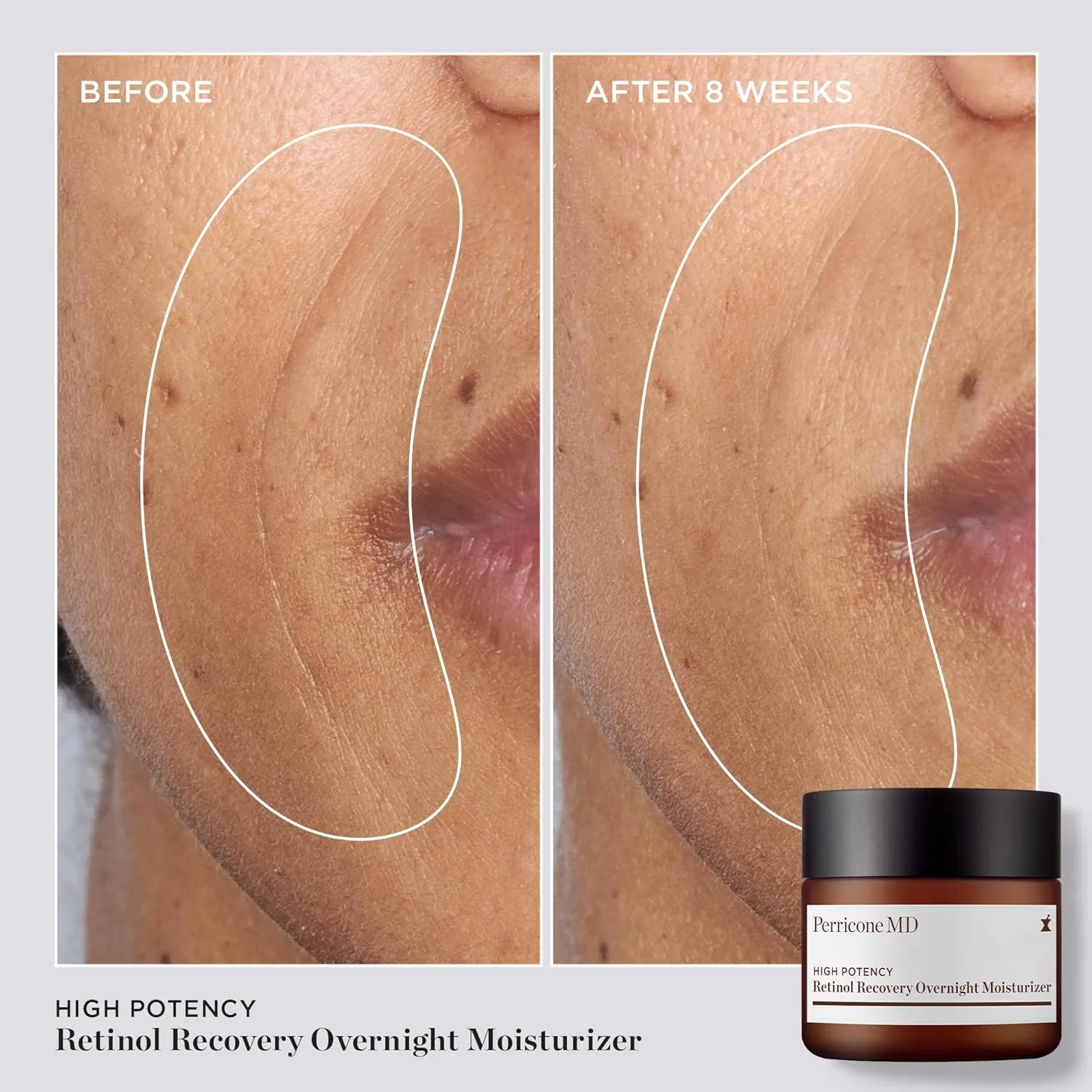 Крем для лица Perricone Md — Ночной увлажняющий с ретинолом High Potency Retinol Recovery, 59 мл — фото 3