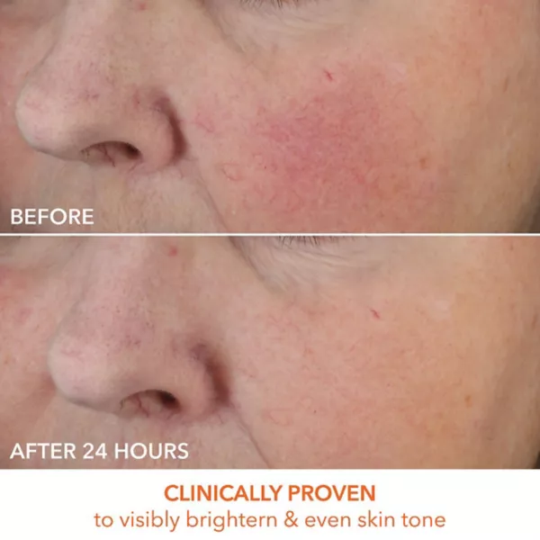 Крем для лица Dr. Dennis Gross Skincare — Витамин С молочный с насыщенным вкусом — фото 2