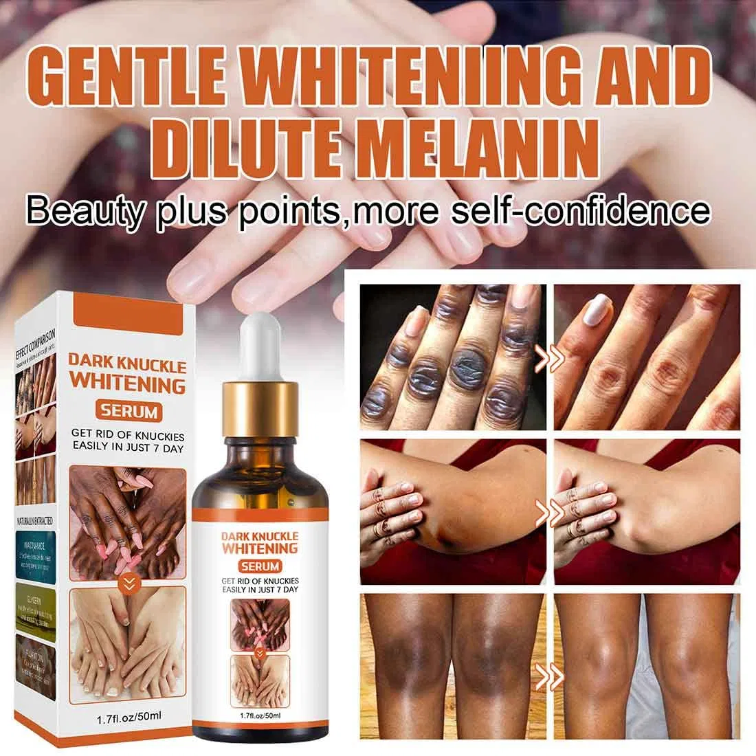 Масло для тела Acanthosis Nigricans Therapy Oil, 3 x 50 мл Generic — фото 4