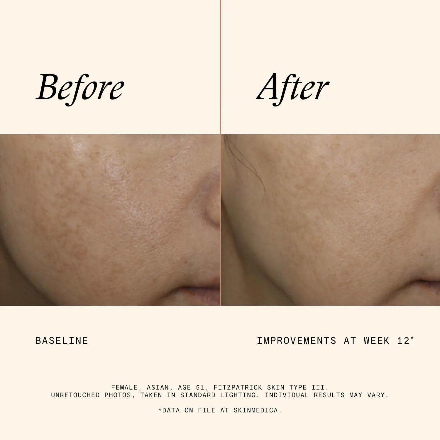 Осветляющая сыворотка для лица SkinMedica Even & Correct Advanced Brightening Treatment Face Serum 50 мл (1 шт.) — фото 4